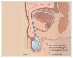 Slider image (10) Adiva | Super Speciality Care
